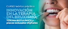 Curso te&oacute;rico pr&aacute;ctico: Innovaci&oacute;n en la terapia del bruxismo, toxina botul&iacute;nica y placas oclusales digitales